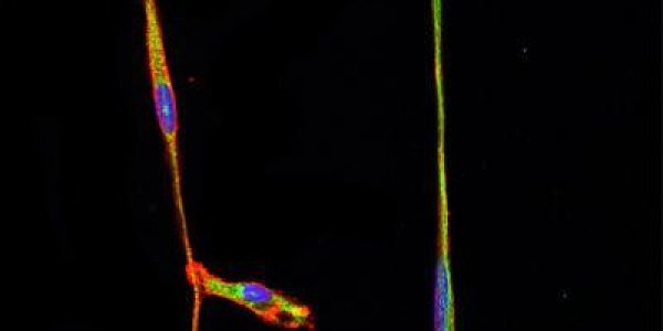 Transdifferentiation: Antibody Directly Transforms Bone Marrow Cells Into Brain Cells