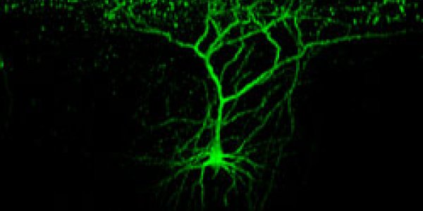 The Adaptive Brain In Action
