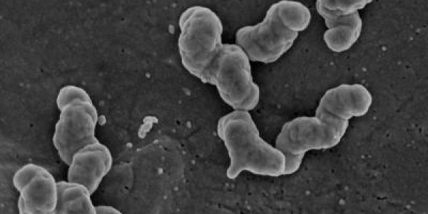 Nitrogen-Transforming Bacteria: Now Powered By Hydrogen