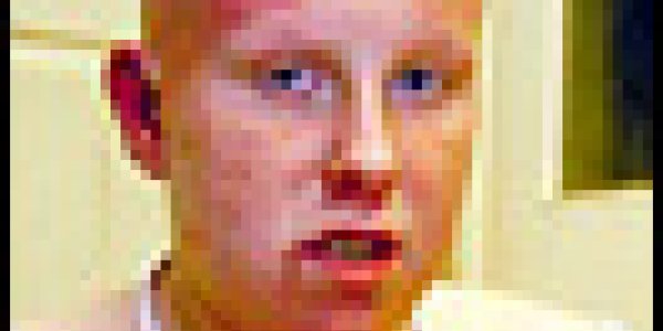 Lesson from the past: Radiation Therapy Overexposure