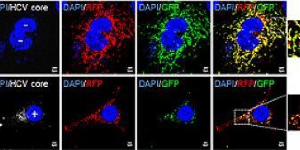 Hepatitis C Drugs Show Patients Benefit Most From Treatment Choices