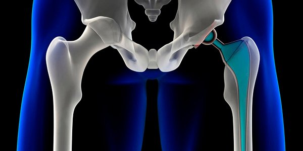 Nanostructures Could Lead To Your Future Cyborg Robot Chassis