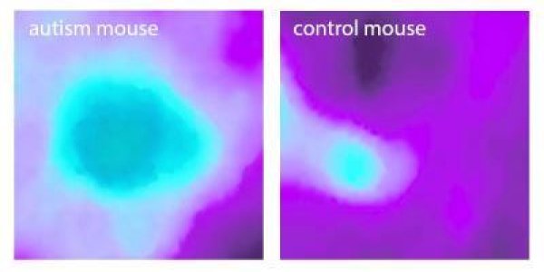 Mouse Models Of Autism Show Insular Cortex Alterations