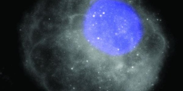 Target Brown Fat And You Target Obesity