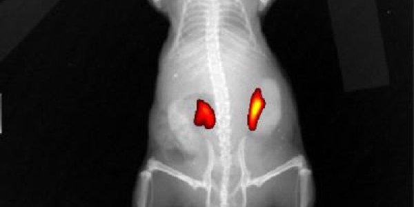 Antidepressant Plus Dye Yields Tumor-targeting Tool