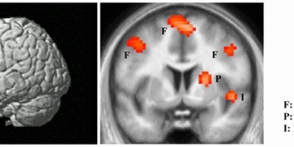 Brain's 'Hate Circuit' Identified