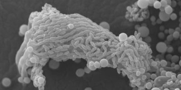 Deadly Human Pathogen Cryptococcus Fully Sequenced