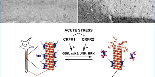 The Link Between Stress and the Development of Alzheimers