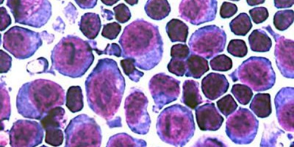 Researchers Discover Hormone That Controls Supply Of Iron In Red Blood Cell Production