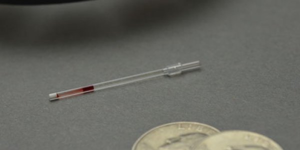 Sickle Cell Is Still A Killer But This 50 Cent Test Could Change That