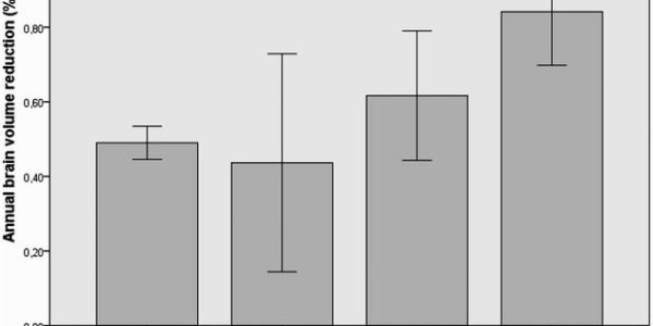 Antipsychotic Drugs Linked To Reduced Brain Volume
