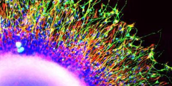 New Stem Cell Research Points To Early Indicators Of Schizophrenia