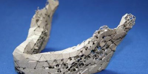 Prototyping Machine 'Bakes' New Bones From Metal Powder