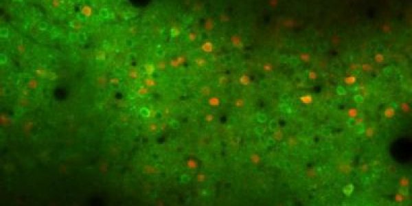 Motor Cortex Shown To Play Active Role In Learning Movement Patterns