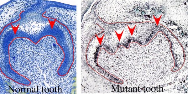Jagged2 Gene Brings Teeth Into Shape