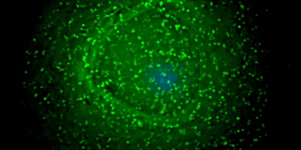 Scientists Develop Method (That Works) To Create Proteins In Laboratory