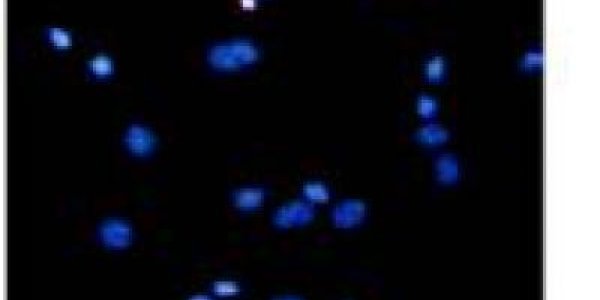 Study Finds Neuroprotective Effects Of Asiaticoside