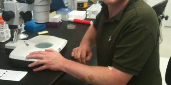 Amino Acid's Increase Is Suspected In Diabetes