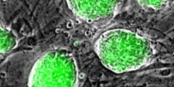 Histones May Hold The Key To The Generation Of Totipotent Stem Cells