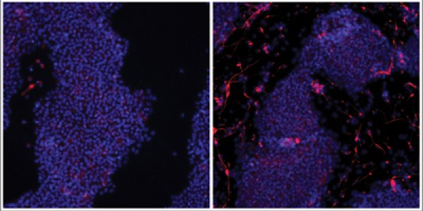 Regenerative Medicine: Cas9 Approach And Activating Genes On Demand