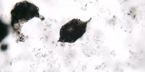 3 Billion-Year-Old Plankton Microfossils Found