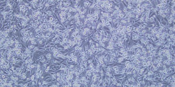 When Cancer Cells Stop Acting Like Cancer