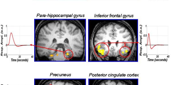 Even When You Sleep, Your Brain Is Awake