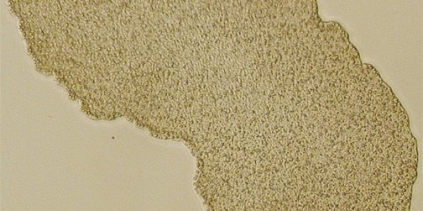 Kudos on the placozoan genome!