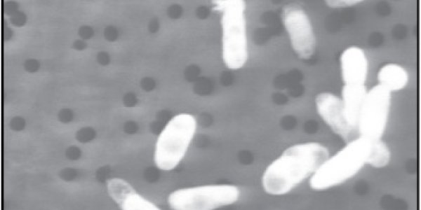 GFAJ-1: Has This Microbe Redefined The Definition Of Life?