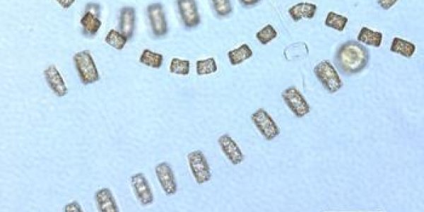 Spring Plankton Bloom Hitches A Ride On Ocean Eddies