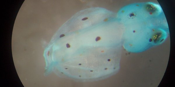 Stained Squid, Part I