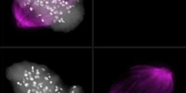 Two Are Better Than One – Another Checkpoint Enzyme For Flawless Cell Division