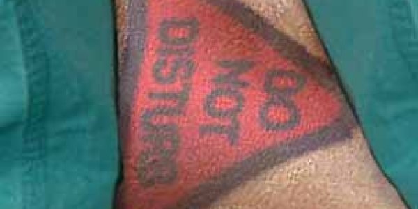 How surgeons can (and perhaps should) avoid disrupting tattoos