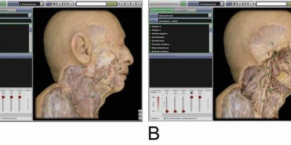 For Learning Anatomy, Cadavers Still Work Best
