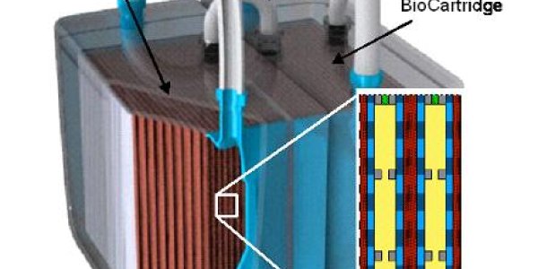 Implantable Bio-Artificial Kidney Could Replace Dialysis