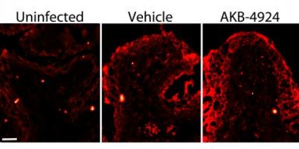AKB-4924 Experimental Drug Boosts Urinary Tract Ability To Fight Infections
