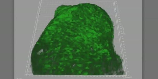 New Shrinking Gel Steers Tooth Tissue Formation