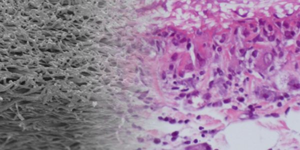 Endogenous Material For Artificial Blood Vessels