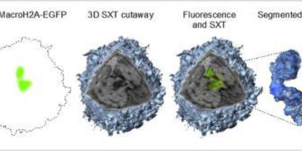 Calico Cats Inspire X Chromosome Research