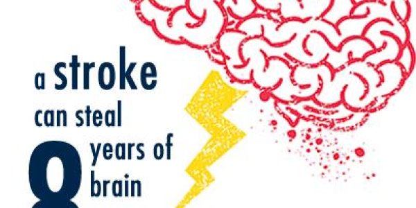 Strokes Steal 8 Years Worth Of Brain Function