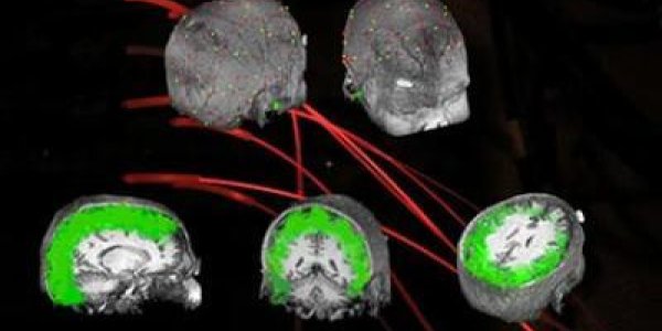 Controlling Brain Waves To Improve Vision