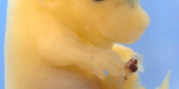 Evolving A Bigger Brain With Human DNA