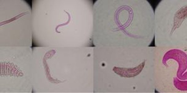 Bottom Trawling Causes Deep-sea Biological Desertification