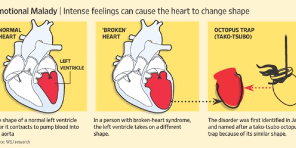 Broken Hearts: Not Just Fodder For Songwriters