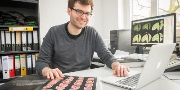 Forgetful? It Might Be Your Genes, Not Senility