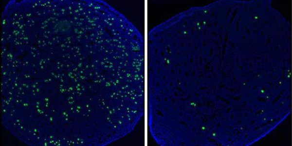 Mutation May Cause Early Loss Of Sperm Supply