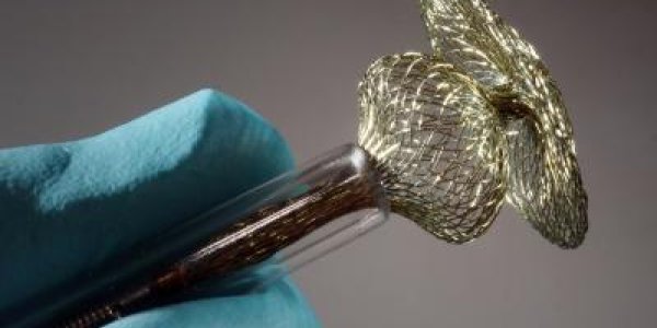 Nickel-Titanium Heart Implants Aren't Dangerous For People Allergic To Nickel