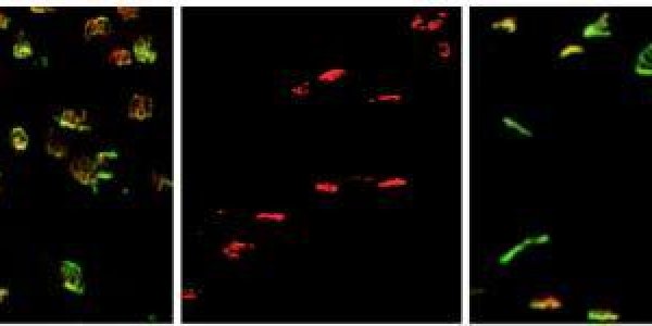 Study Identifies Gene Tied To Motor Neuron Loss In ALS