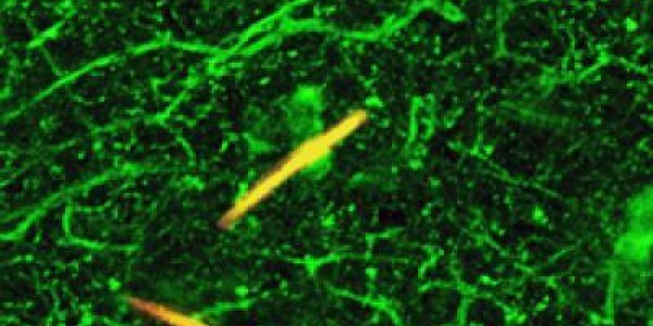 Brain Uses Serotonin To Perpetuate Chronic Pain Signals In Local Nerves