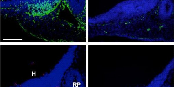 The Brain Belly Connection In Weight Regulation